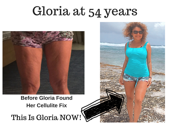 gloria's awesome cellulite success story before and after photos